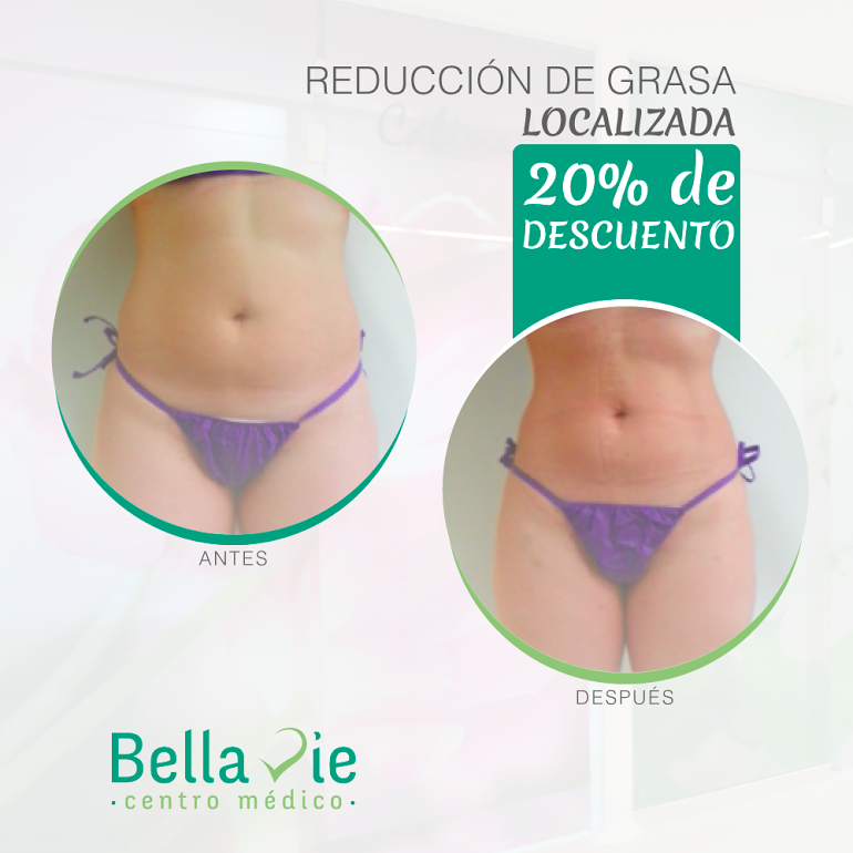 Landing Bella Vie Centro De Medicina Estética Mamoplastia En Medellín Lipólisis Láser